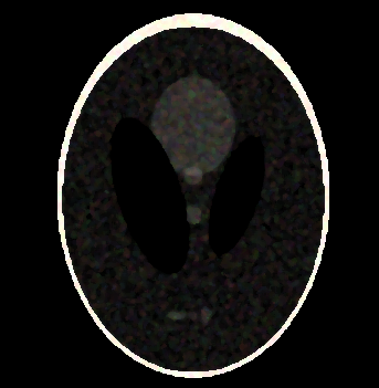 k-space MRI artifact sculptor icon
